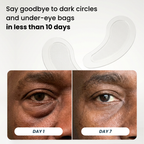 Microneedle Patches | New Generation
