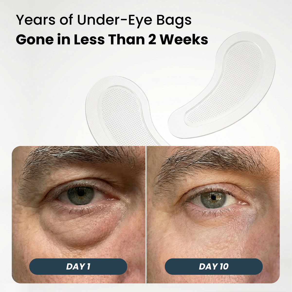 Microneedle Patches | New Generation