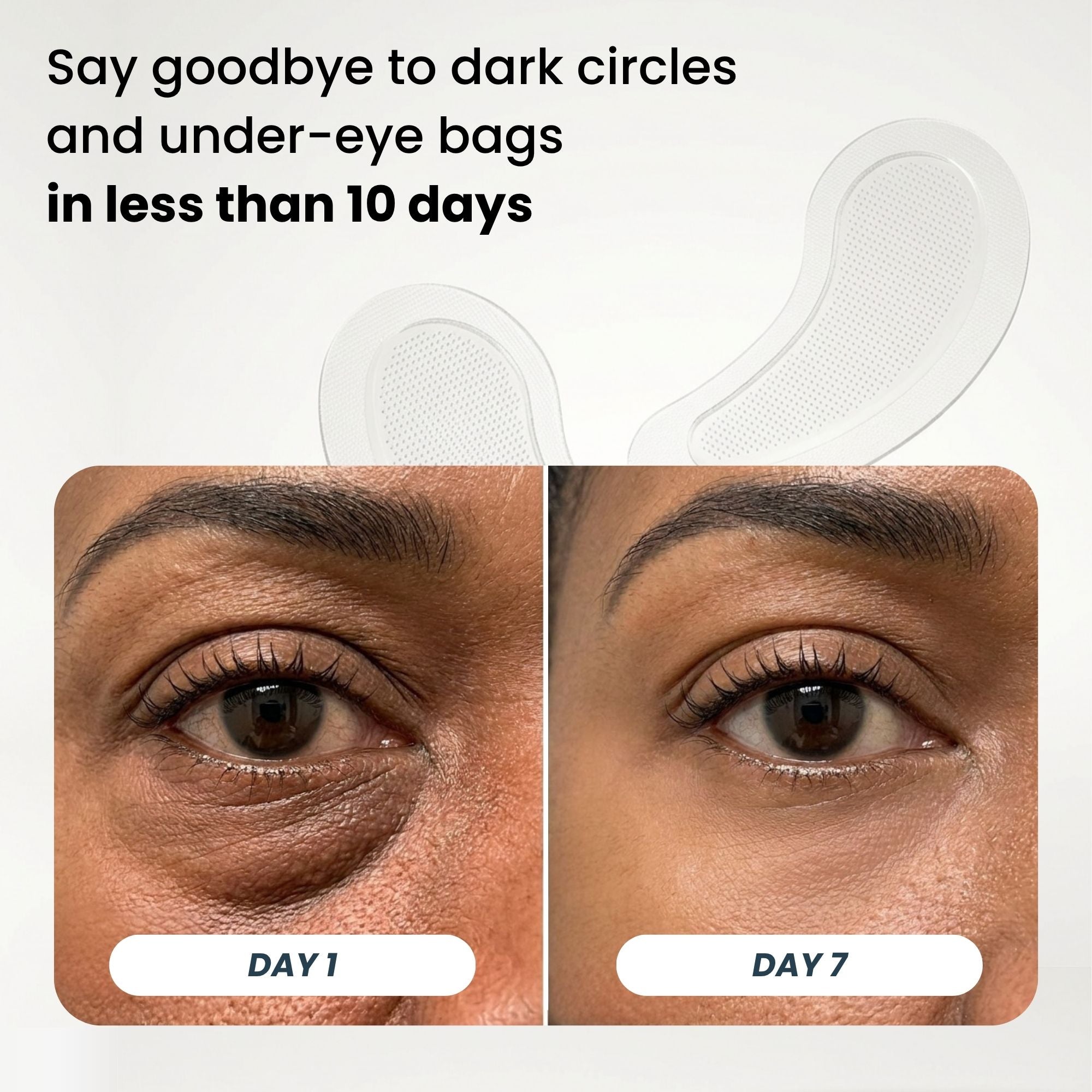 Microneedle Patches | New Generation